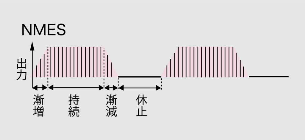 HVMC デルタ
