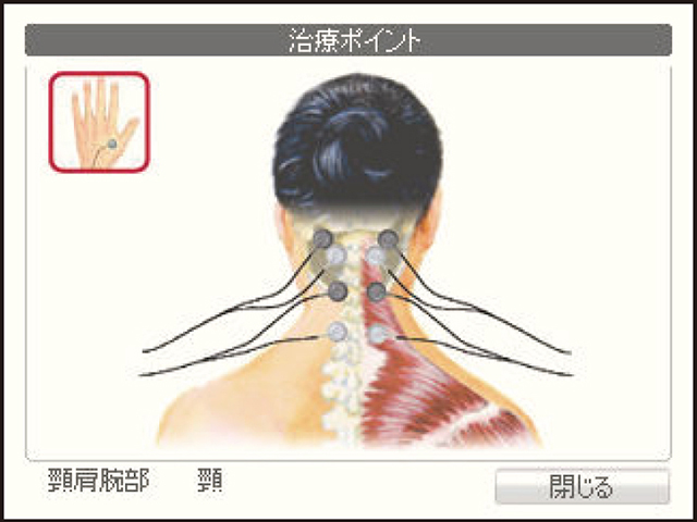 SSPアルファ1