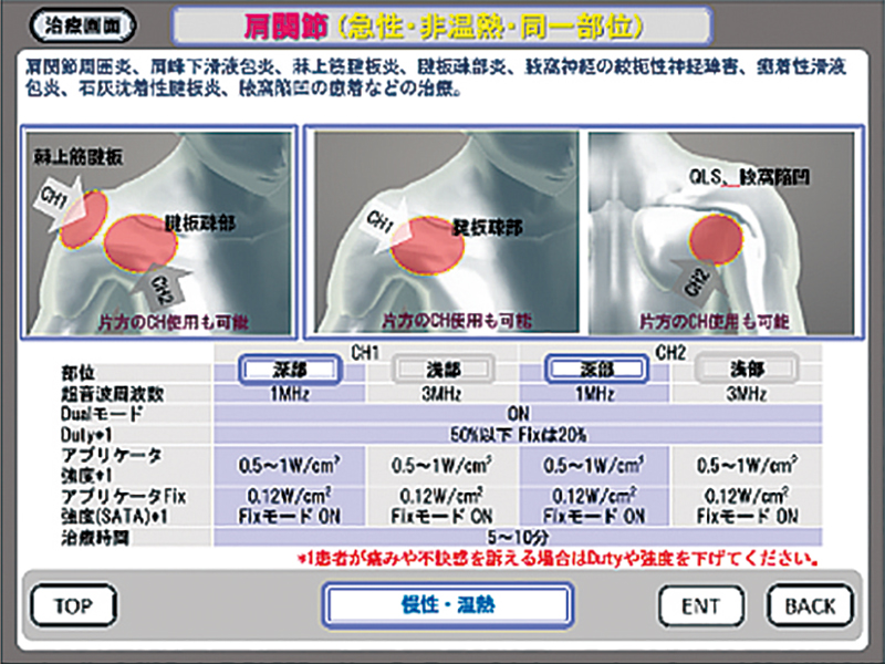 ULTRASON RE-3000