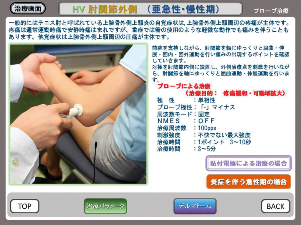 HVMC デルタ