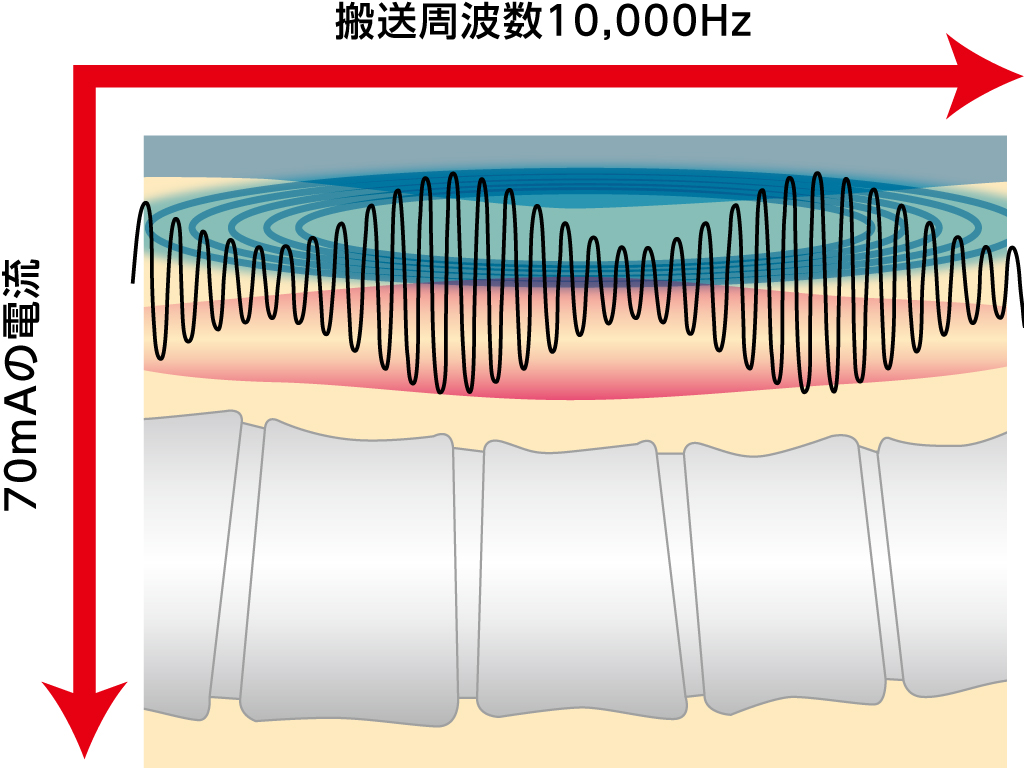 IFCアルファ1