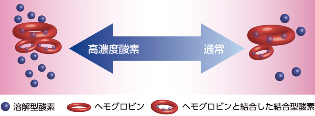 高気圧酸素ルーム O₂ルーム ブレッドタイプS