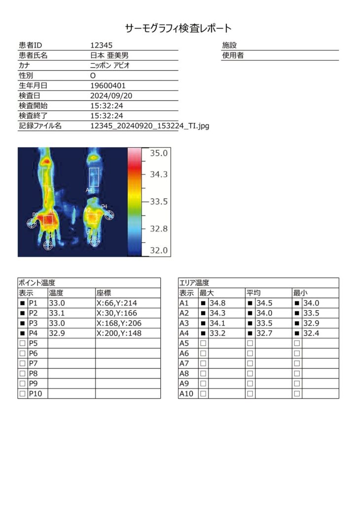 医用サーモグラフィ F50ME