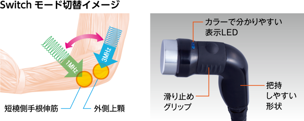 ULTRASON RE-3000
