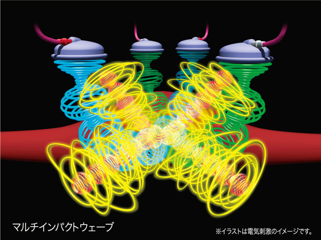 セダンテ ネオ　F/H/S